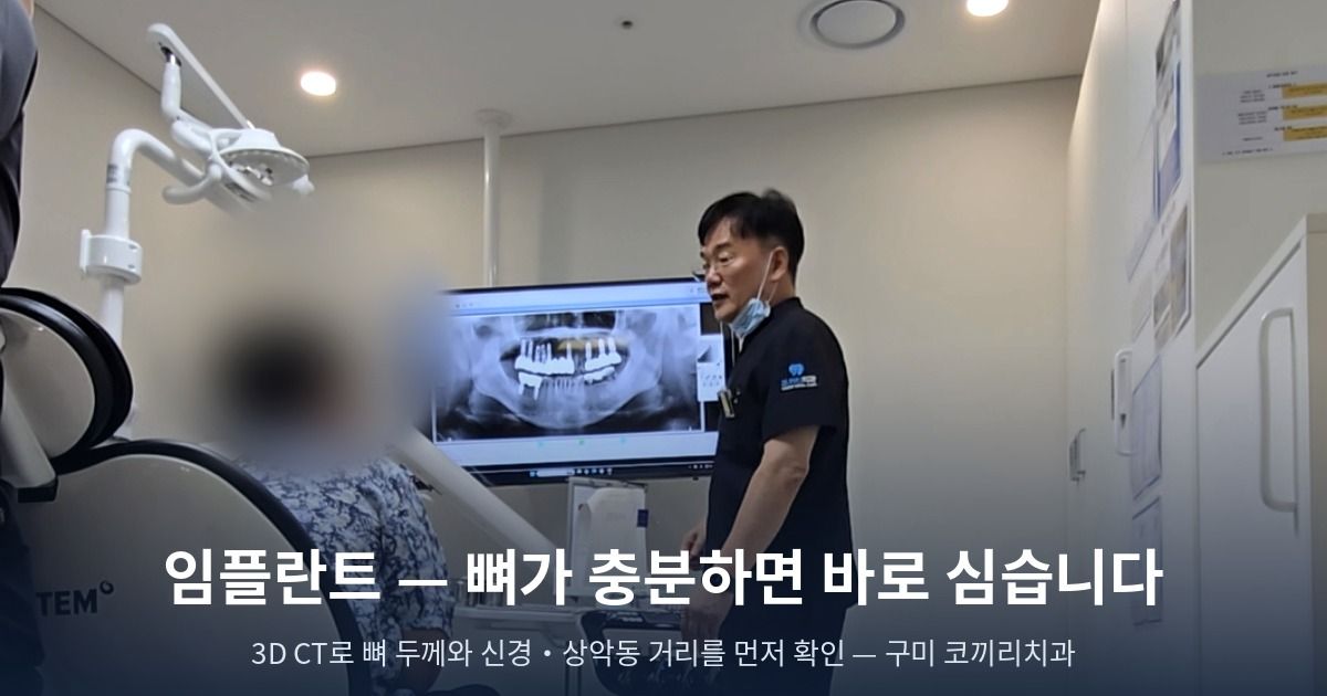 일반 임플란트