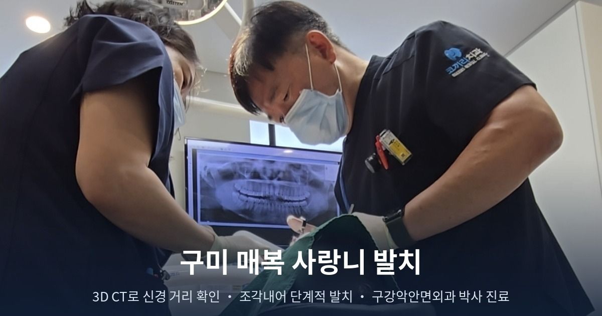 구미 매복 사랑니 발치